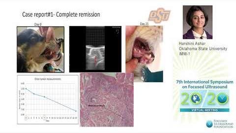 Ultrasound Techniques Key in Assessing Anti-Vascular Therapy Response