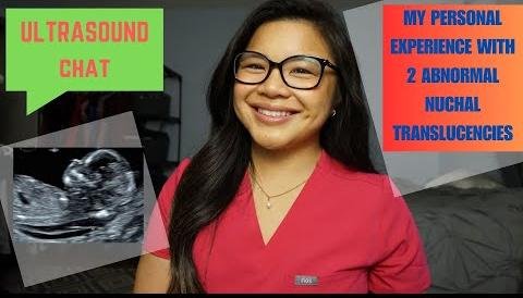 Study Reveals Higher Risks for Fetus with Increased Nuchal Translucency