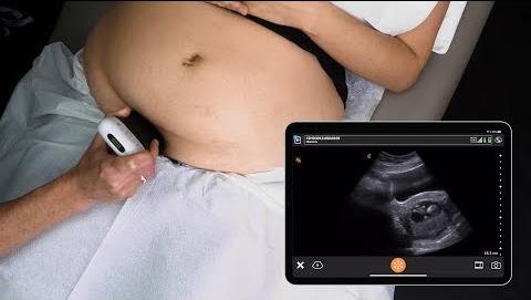 Chinese Researchers Develop Accurate Gestational Age Estimation Formula