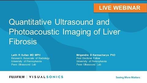 Quantitative Ultrasound Imaging: A Non-Invasive Tool for Hepatic Fibrosis