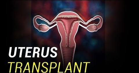 Deceased Donor Uterus Transplantation: Addressing Religious Perspectives Safely
