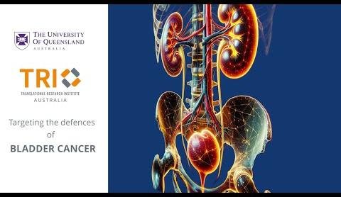 University of Queensland Researchers Make Breakthrough in Bladder Cancer Immunotherapy