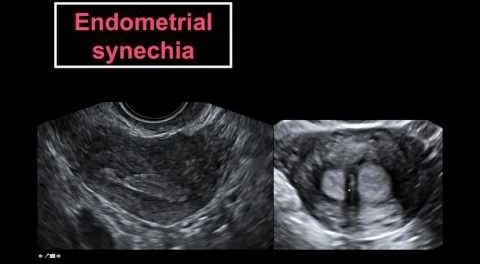 Enhancing Female Infertility Diagnosis with Multimodal Imaging Techniques