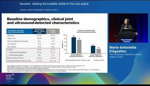 Ultrasound Bursitis Predicts Psoriatic Arthritis Development in Psoriasis Patients