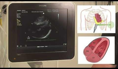 Philips Launches Flash 5100 Ultrasound for Critical Care Efficiency