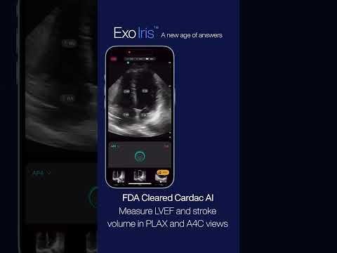 Exo’s FDA-Cleared AI Apps Revolutionize Lung Disease Detection