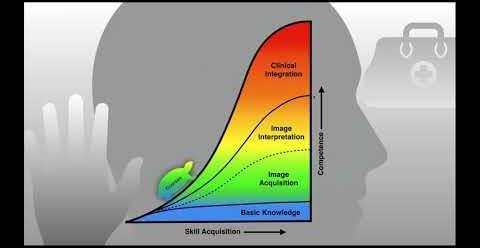 Enhancing Internal Medicine Residency with Longitudinal POCUS Curriculum