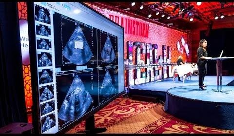 Community Fundraiser Raises $16,000 for Women’s Health Ultrasound