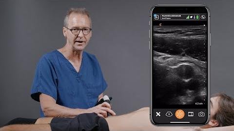 Ultrasound Imaging Proves Effective in Diagnosing Appendicitis in Men