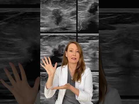 ABVS and UE Integration Enhances Breast Lesion Diagnosis Accuracy