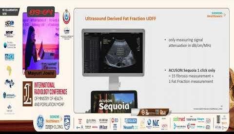 Advanced Ultrasound Techniques Transform Hepatic Steatosis Diagnosis