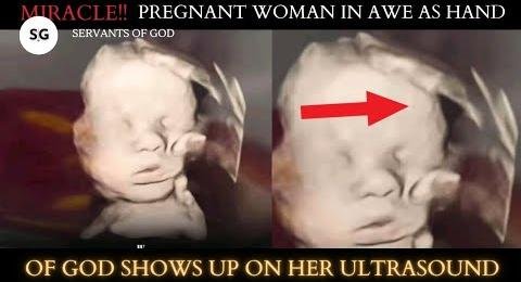 Mother’s Faith: Ultrasound Miracle Reveals Divine Protection
