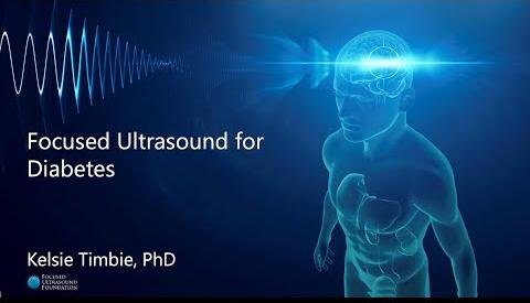 Focused Ultrasound Improves Insulin Sensitivity in Surgical Stress