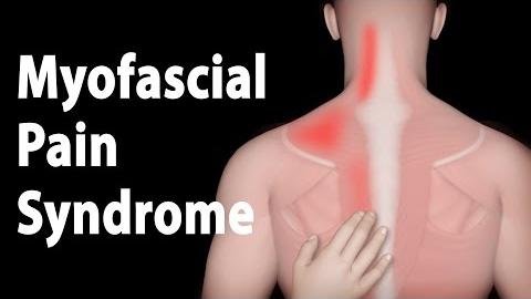Ultrasound Imaging Reveals Insights into Myofascial Pain Syndrome Treatment