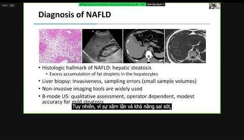 Ultrasound-Derived Fat Fraction: A Key Tool for Liver Health