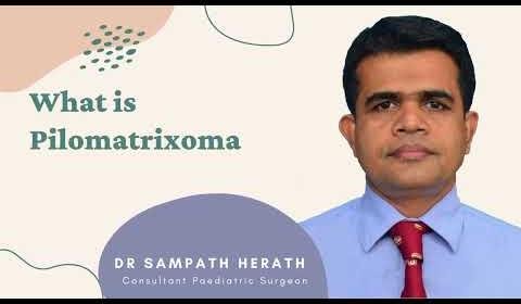 Ultra-High-Frequency Ultrasound Reveals Insights into Pilomatricoma in Children
