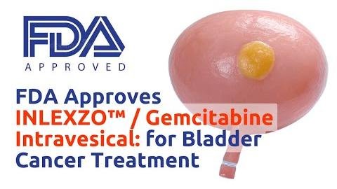 FDA Approves Inlexzo System for BCG-Unresponsive Bladder Cancer