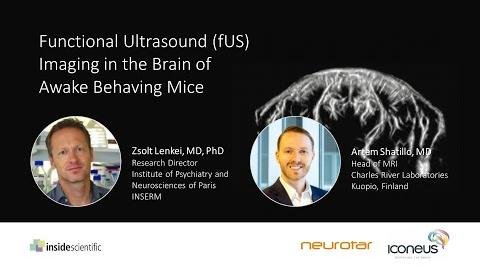 Breakthrough 3D Ultrasound Imaging in Awake Mice Revolutionizes Neuroscience