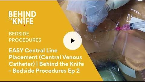 Enhancing Central Line Placement with Infrared Vein Visualization