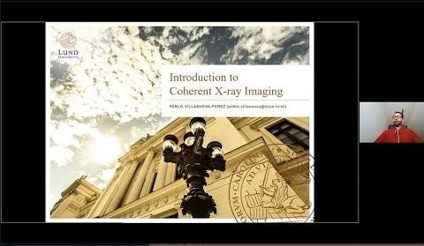 Compact Laser Plasma Source Enhances X-ray Coherence Tomography