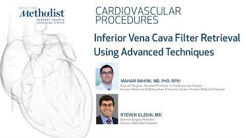 Inferior Vena Cava Atresia: Challenges, Complications, and Treatment Advances