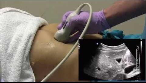 Ultrasound Scans: A Vital Tool for Medical Diagnosis