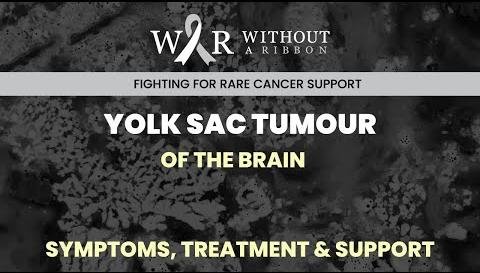 Rare Intracranial Yolk Sac Tumor in Basal Ganglia Treatment