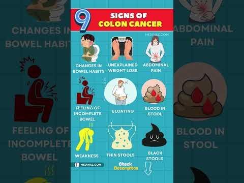 Global Concern: Rising Trend of Early-Onset Gallbladder Cancer