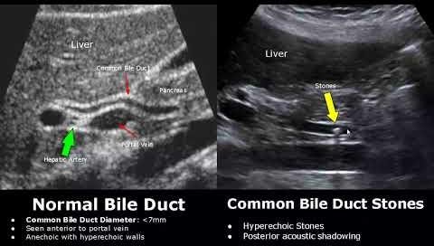 CT vs. Ultrasonography in Diagnosing Canine Biliary Diseases