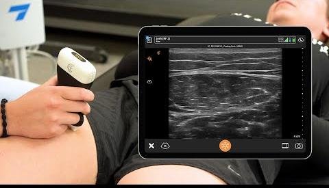 Panoramic Ultrasound Proves Valid for Assessing Muscle Size