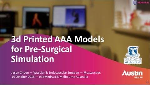 Groundbreaking 3D-Printed Aorta Surgery Saves Man’s Life