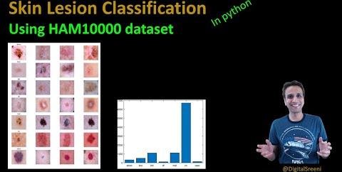 Revolutionizing Skin Cancer Detection with iToBoS Dataset