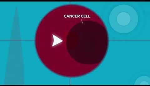 Public Hospitals Halt Groundbreaking Prostate Cancer Drug Access